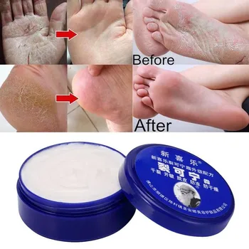 จีนดั้งเดิม 33g น้ำมันต่อต้าน Drying อ่านตีครีมส้นเท้าถอดซ่อมแซมครีมการลบตายมือของผิวหนังเท้าสตีนหน้ากาก